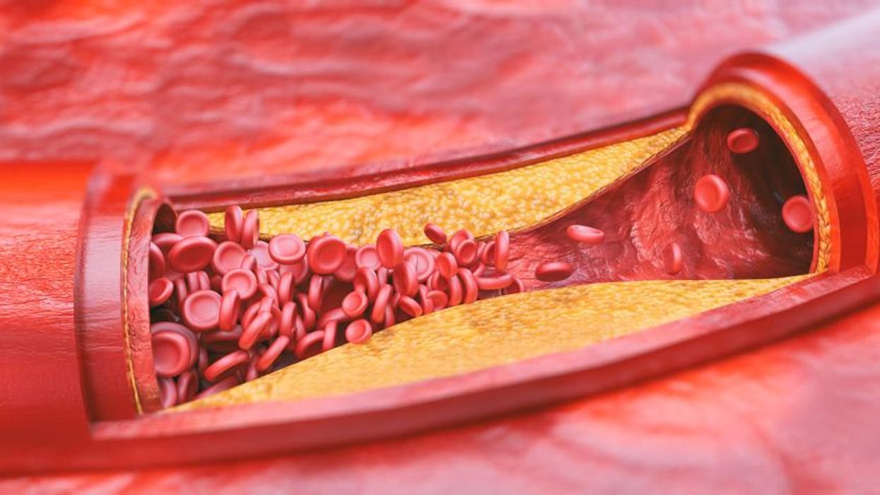 kolesterol - vitamin c - zima - herba.hr - imunitet - prehlada - virusi - bakterije - mediteranski faktor - biljna ljekarna
