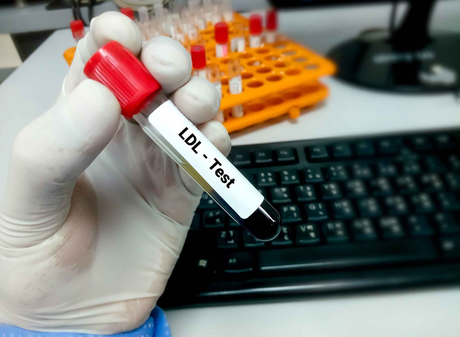 LDL Test